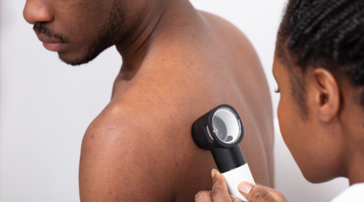 African american man getting a skin exam