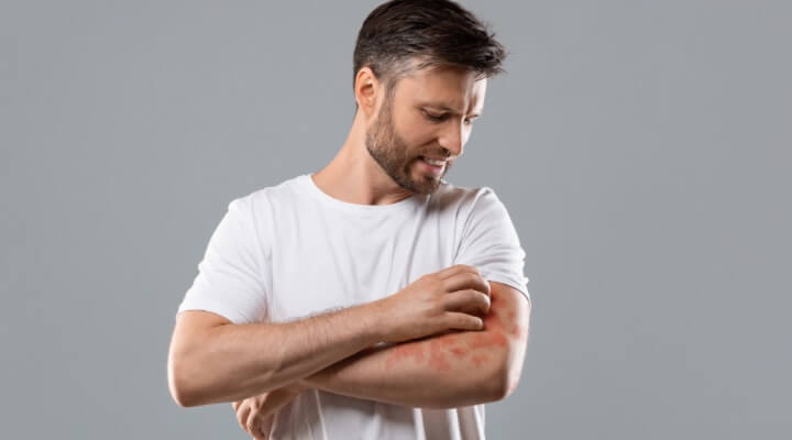 Man scratching arm