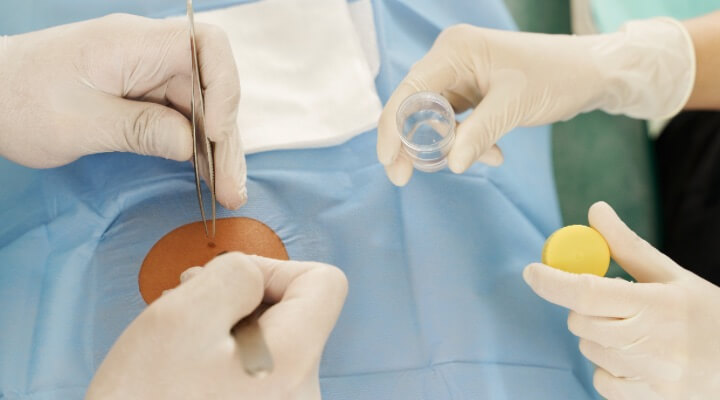 physician performing mohs surgery