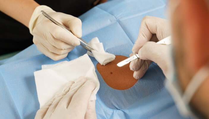 providers performing mohs surgery