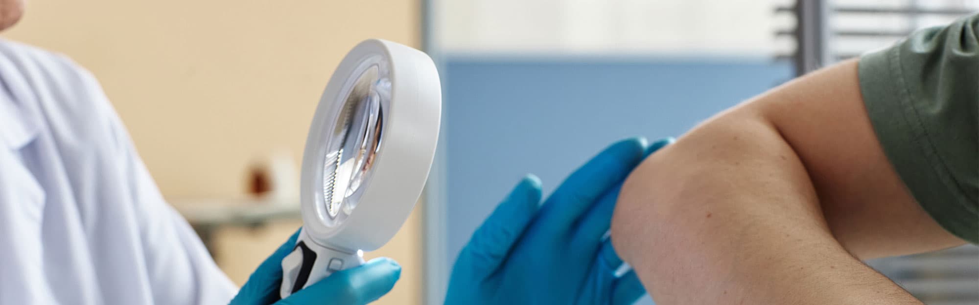 Skin Surgery Center Blog Hero - Tips for Managing Granulomas