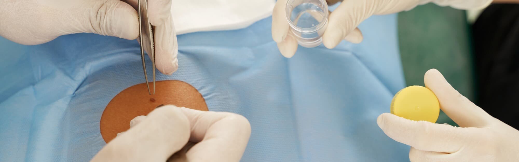 Skin Surgery Center Blog Hero - Common Myths and Misconceptions About Mohs Surgery